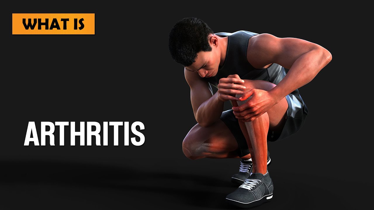 What Is Arthritis YouTube