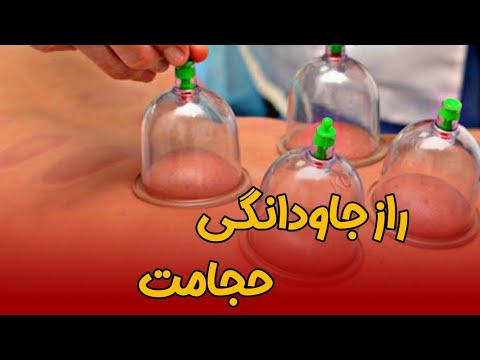 تصویری: حجامت چیست و برای چیست؟