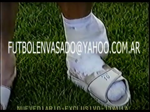 El día que Diego Maradona jugó contra Brasil con el tobillo lesionado