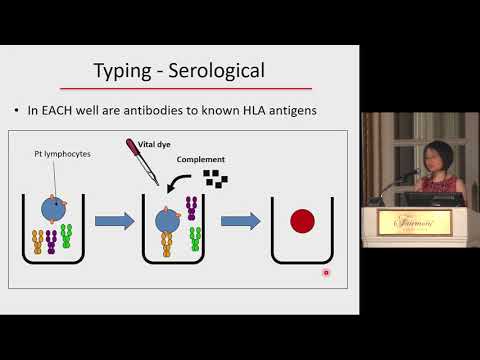 Brigham Renal Board Review, immunological assessment pre and post transplant