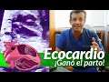 Ecocardiografía Fetal ¡Ganadora del parto!