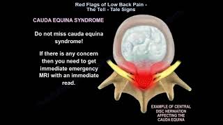 When does low back pain become a cause for concern? Learn about red flags when you see the doctor.