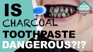 Is Charcoal Toothpaste Dangerous? | Review Of Different Charcoal Products