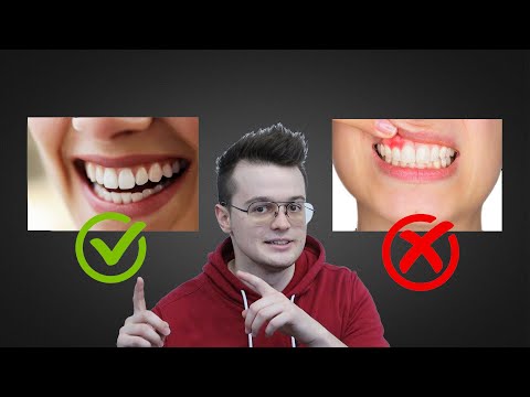 Video: Zakaj Sanjajo Bolni In Padajoči Zobje?