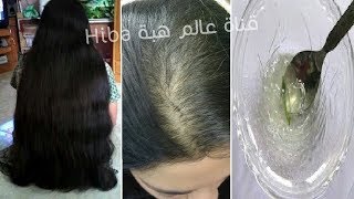 الوصفة المعجزة لانبات فراغات الشعر و الصلع في أسبوع أقسم بالله النتيجة ستبهرك ب4 مكونات فقط