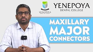 Maxillary Major Connectors | Prosthodontics | Yenepoya Dental College
