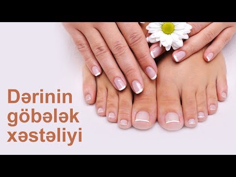 Video: İtlərdə Dərinin Göbələk Xəstəliyi (Sporotrixoz)