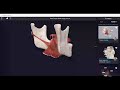 Introductory webinar on complete anatomy 3d4medical from elsevier