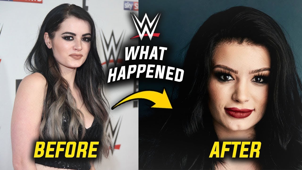 wwe, paige, paige wwe, paige face surgery, wwe paige botox, wwe...