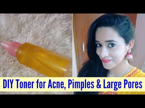 DIY Magical Toner For Acne, Pimples & Large Pores | Apple Cider Vinegar Toner | Just another girl