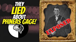 Who was Phineas Gage? What the textbooks get wrong about his famous brain injury