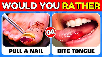Would You Rather...?  Pain Edition 💥– Are You Brave Enough to Face the Hardest Choices?
