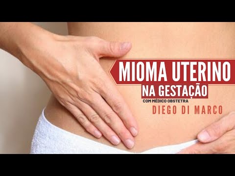 Vídeo: Miomas Uterinos Durante A Gravidez - Por Que é Perigoso? Como Tratar?