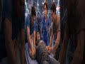 🚨 أخطاء شائعة قد تؤذي مريض التشنجات بدل إنقاذه#shorts