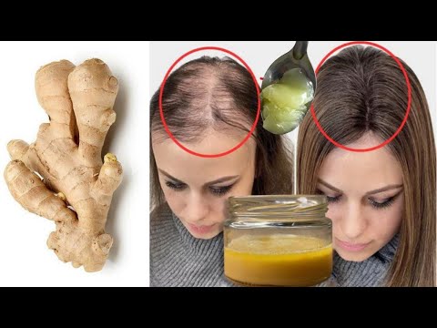 Mix Ginger And Vaseline Hair Will Grows Like Crazy And Does Not Fall Out Treats Baldness