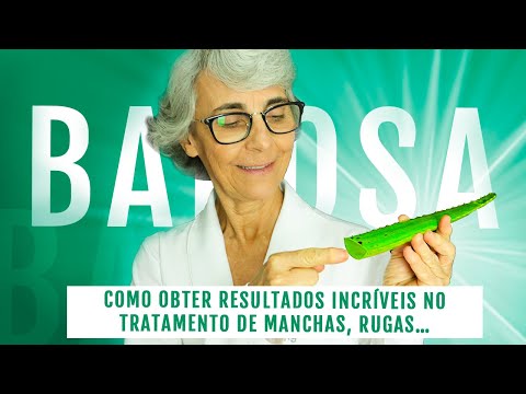 Vídeo: Aloe Vera Para Psoríase: Benefícios, Usos E Muito Mais