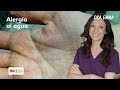 La Dra Emma y el extraño caso de urticaria acuagénica | Dra Emma: clínica dermatológica