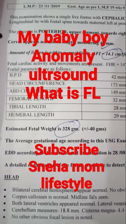 what is FL parameter in anomaly ultrasounds