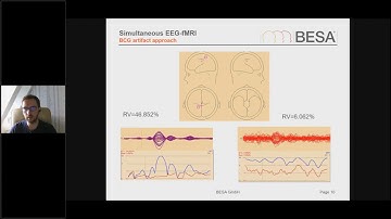Webinar: Analyzing joint fMRI-EEG recordings