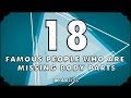 18 Famous People Who Are Missing Body Parts - mental_floss on YouTube (Ep.202)