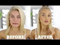 EVERYDAY MAKEUP FOR ACNE PRONE SKIN + Personal Life Update