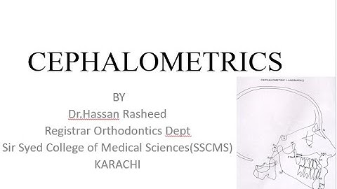 Cephalometrics lecture no 2 | Dr.Hassan Rasheed