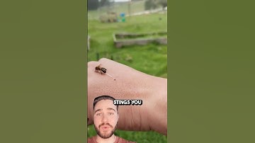 What To Actually Do When Stung By A Bee!