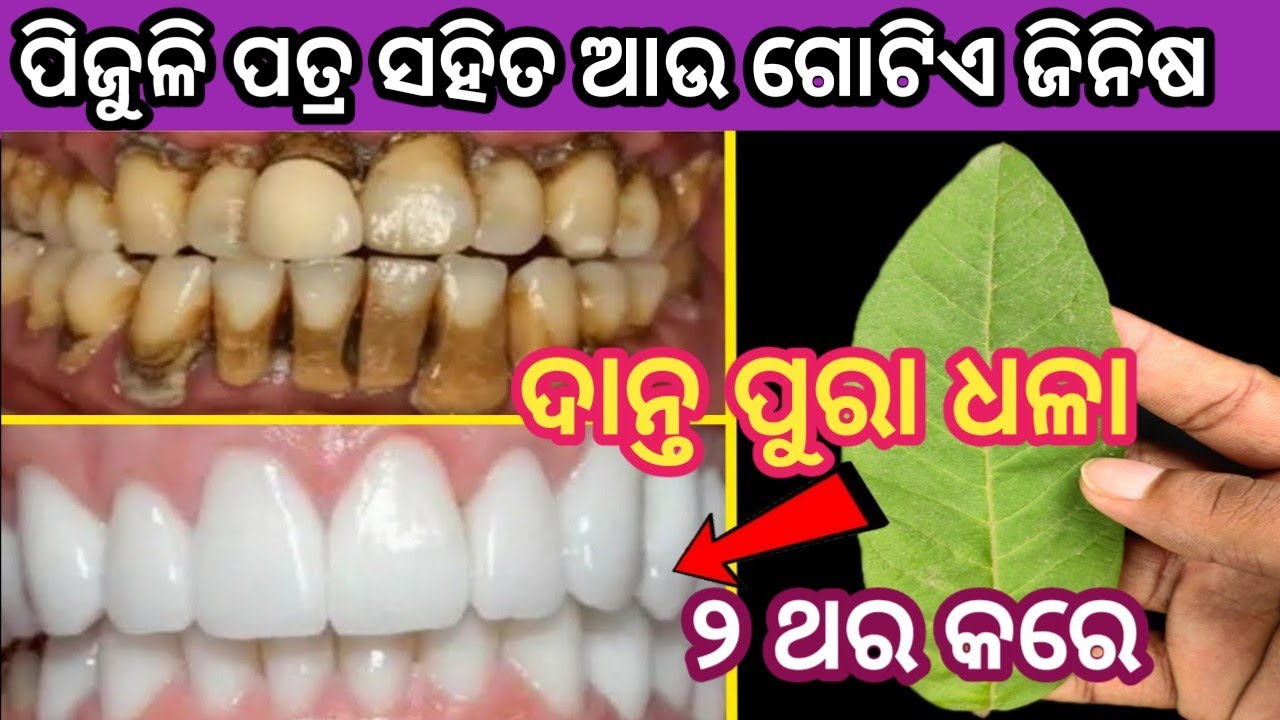 ଗୋଟିଏ ପିଜୁଳି ପତ୍ର ରେ ଦାନ୍ତ ପୁରା ଧଳା ସବୁଦିନ ପାଇଁ #teethwhitening odia #danta safa heba #danta dhala