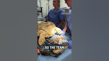 Thumbnail of Removing barnacles stuck on a turtle! 😮🐢  -  🎥 turtlehospital