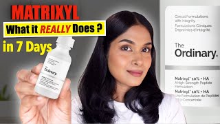 Matrixyl 10% + HA Review | The Ordinary | Sensitive Skin, Anti-Aging, Real Results?