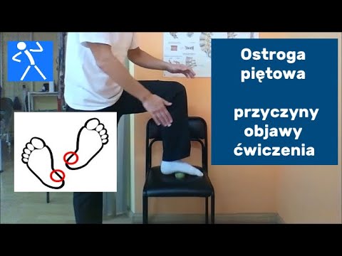 Wideo: Ostroga Piętowa - Leczenie, Objawy, Rokowanie