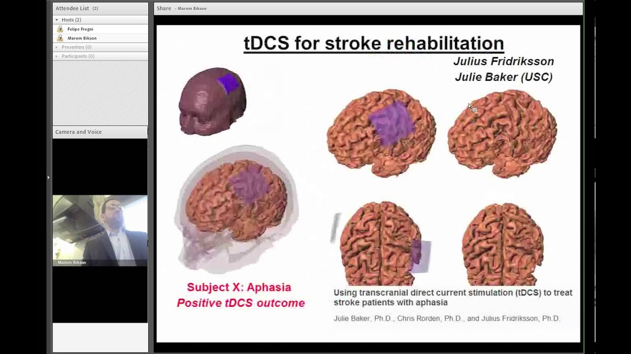 Tdcs Placement Chart