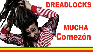 ¿Por qué pican las rastas?