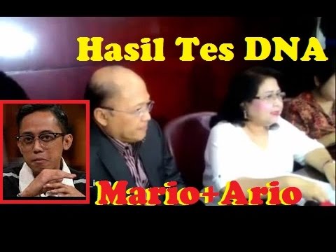 hasil togel hari ini indonesia