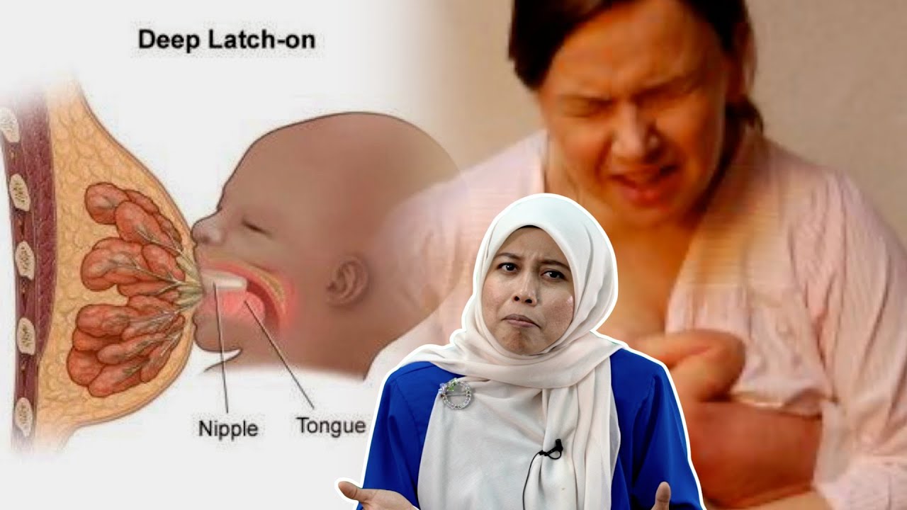 Ini Punca Puting Ibu Sakit Semasa Menyusu