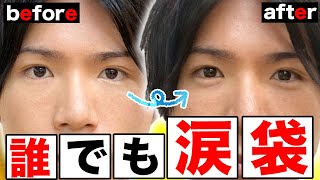 メンズ必見 涙袋は男でも作れる メイク マッサージ全て紹介 Men S メンズ必見 涙袋は男でも作れる メイク マッサージ全て紹介 Men S