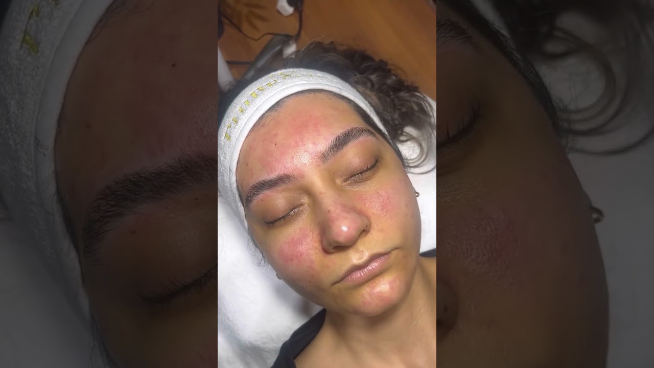 Altınoran kaş alımı💫 