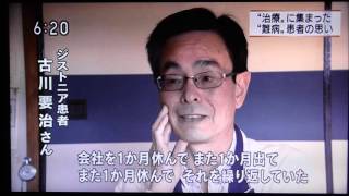 NHK高松放送局取材 ジストニアとは 検索動画18 NHK高松放送局取材 ジストニアとは 検索動画 18