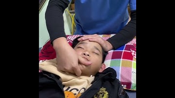 Cách massage điều trị liệt dây thần kinh số 7 đúng cách #Shorts