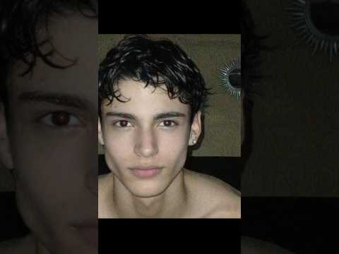 1 year mewing (insane change) #mewing #shorts