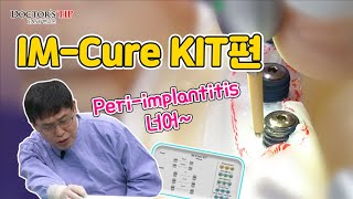 [IM-Cure KIT] Implant Surface Polishing using Smartbrush 1&2