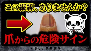 【放置厳禁】見逃すと危険！爪からのSOSサインとは？