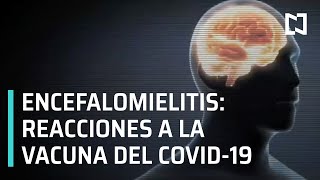 Efectos secundarios de la vacuna contra el Covid-19 | ¿Qué es la Encefalomielitis? - Al aire