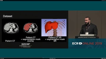 ECR 2019: Witowski Jan - Automatic liver segmentation