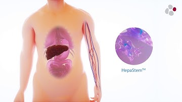 HepaStem : Stem Cell Technology as a Potential Treatment for NASH and ACLF