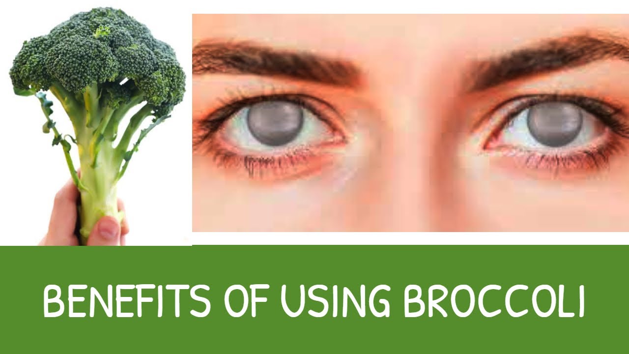 For Healthy Eyes, Think BROCCOLI and not CARROTS - YouTube