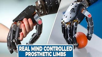 Real Mind-Controlled Prosthetic Limbs