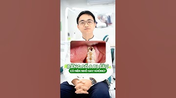 Răng số 8 bị sâu: Có nên nhổ không? Lời khuyên chuyên gia dành cho bạn #nhasycuaban #rangkhon