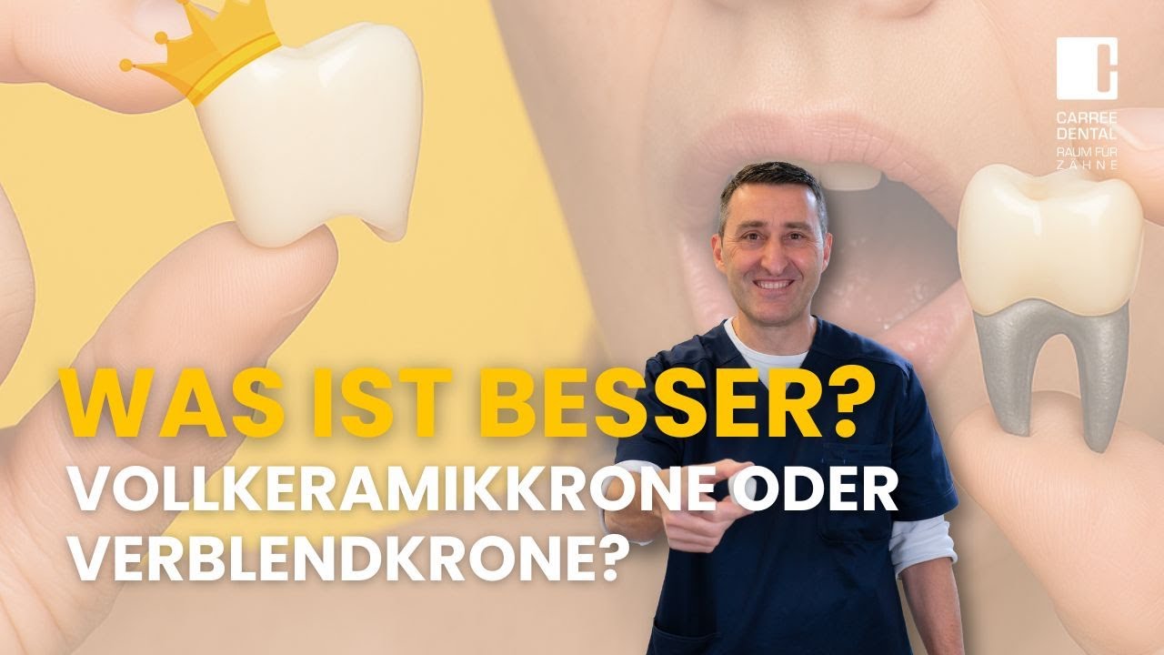 Die bessere Krone? Vollkeramik vs. Verblendung – so triffst du die richtige Entscheidung!