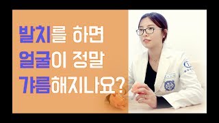 발치를 하면 얼굴이 정말 갸름해지나요? - 원데이치과 윤소정 원장님